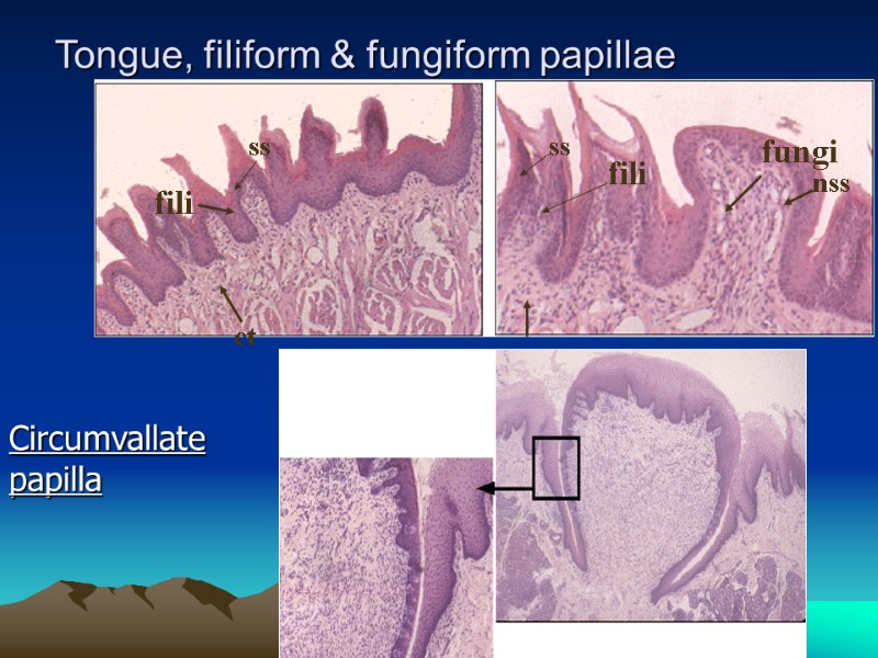 Tongue, filiform & fungiform papillae fili fili ct ct ss ss fungi nss Circumvallate